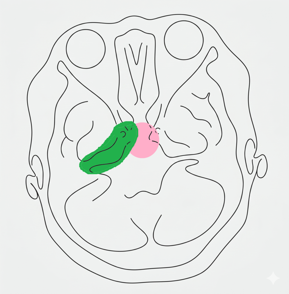 脳腫瘍イラスト